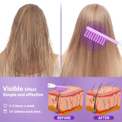 SkinVibe™ Clinical High Frequency Wand